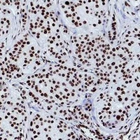 Histone H3 (TriMethyl-K79) Antibody