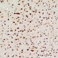 NF-kappaB p65 Mouse Monoclonal Antibody