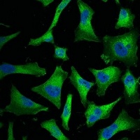 NF-kappaB p65 Mouse Monoclonal Antibody