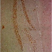 NF-kappaB p65 Mouse Monoclonal Antibody