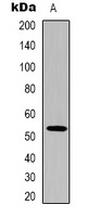 p53 Mouse Monoclonal Antibody