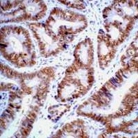 p53 Mouse Monoclonal Antibody
