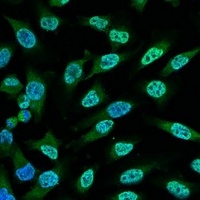 p53 Mouse Monoclonal Antibody