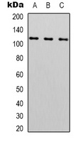 PARP1 Mouse Monoclonal Antibody