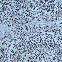 PARP1 Mouse Monoclonal Antibody