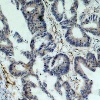 Survivin Antibody