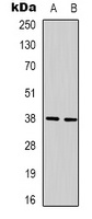 XRCC4 Mouse Monoclonal Antibody
