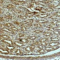 ACTN1 Rabbit Polyclonal Antibody