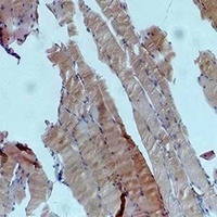 AMPK alpha 1 Rabbit Polyclonal Antibody