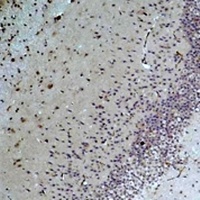 Bestrophin-1 Rabbit Polyclonal Antibody