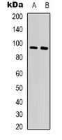 Beta-catenin Rabbit Polyclonal Antibody