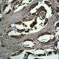 Beta-catenin Rabbit Polyclonal Antibody