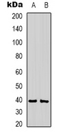 CABP1 Rabbit Polyclonal Antibody