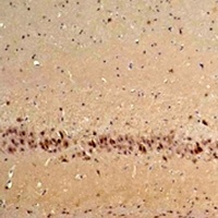 CABP1 Rabbit Polyclonal Antibody