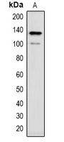 CACNA2D1 Rabbit Polyclonal Antibody