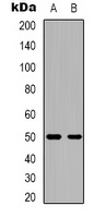 CACNB3 Rabbit Polyclonal Antibody