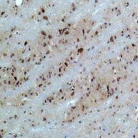 CACNB3 Rabbit Polyclonal Antibody