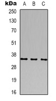 CACNG2 Rabbit Polyclonal Antibody
