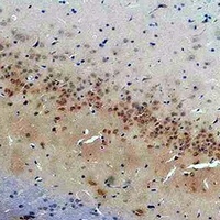 CACNG2 Rabbit Polyclonal Antibody