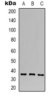 CACNG4 Rabbit Polyclonal Antibody