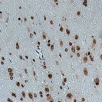CACNG4 Rabbit Polyclonal Antibody