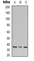 CACNG5 Rabbit Polyclonal Antibody