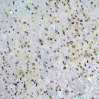 CACNG5 Rabbit Polyclonal Antibody