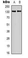 Calcium Sensing Receptor Rabbit Polyclonal Antibody