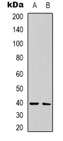 CALHM1 Rabbit Polyclonal Antibody