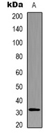 Caspase 3 Rabbit Polyclonal Antibody