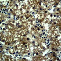 EPG5 Rabbit Polyclonal Antibody