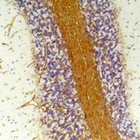 GABRA2 Rabbit Polyclonal Antibody