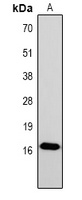 Histone H1 (Phospho-S2) Antibody