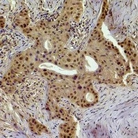 Histone H1 (Phospho-T17) Antibody
