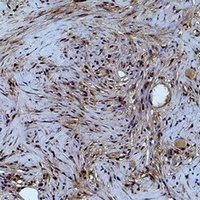 Histone H1 (Phospho-T4) Antibody