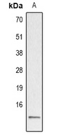 Histone H2A (Acetyl-K5) Rabbit Polyclonal Antibody