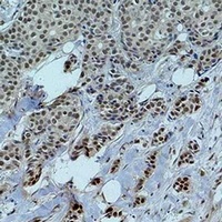 Histone H2A (Acetyl-K5) Rabbit Polyclonal Antibody