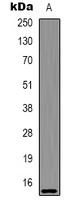 Histone H2A.X (Acetyl-K5) Rabbit Polyclonal Antibody
