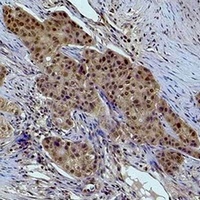 Histone H2A.X (Acetyl-K5) Rabbit Polyclonal Antibody