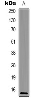Histone H2A.X (Phospho-S139) Rabbit Polyclonal Antibody
