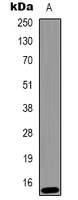 Histone H2A.X (Phospho-Y142) Rabbit Polyclonal Antibody