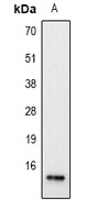 Histone H2A.Z (Acetyl-K7) Rabbit Polyclonal Antibody