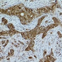 Histone H2A.Z (Acetyl-K7) Rabbit Polyclonal Antibody