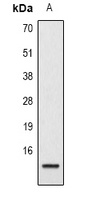 Histone H2B (Acetyl-K15) Rabbit Polyclonal Antibody