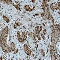 Histone H2B (Acetyl-K15) Rabbit Polyclonal Antibody