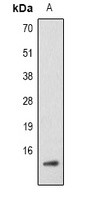 Histone H2B (Acetyl-K5) Rabbit Polyclonal Antibody