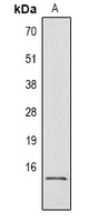 Histone H2B (Phospho-S32) Rabbit Polyclonal Antibody