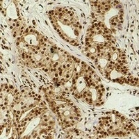 Histone H3 (Acetyl-K9) Antibody