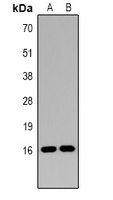 Histone H3 (DiMethyl-K14) Antibody