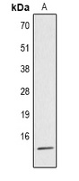 Histone H4 (Acetyl-K5) Rabbit Polyclonal Antibody